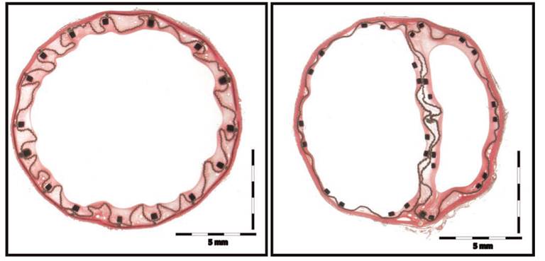 hematoxylin-eosin-stain