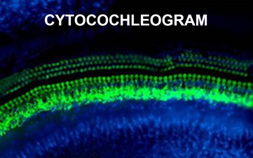 cytocochleogramimage